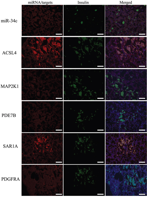 Expression of miR-34c and its targets in pancreatic tissue using in situ hybridization and IHC.