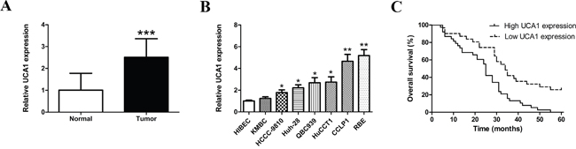 Expression levels of UCA1 in CCA samples and cell lines and its correlation with overall survival.