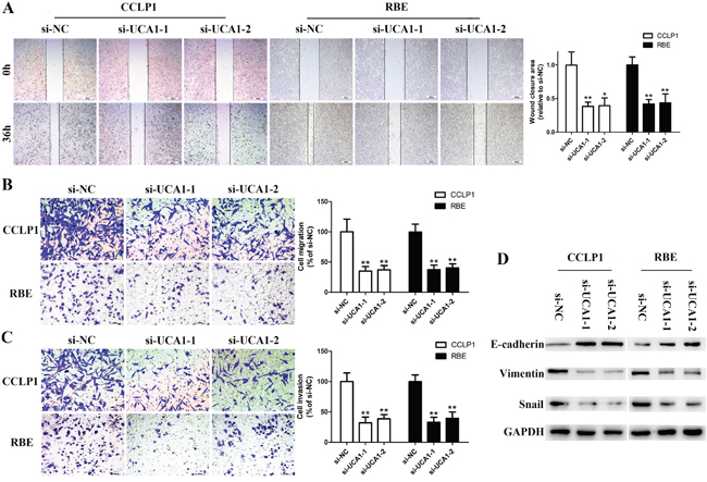 Silenced UCA1 abrogates migration and invasion capacity of CCA cells by reversing EMT.