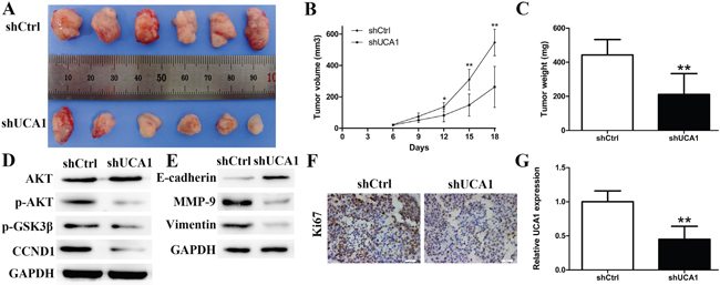 Effect of downregulated UCA1 on tumorgenesis in vivo.