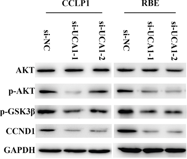 AKT/GSK-3&#x03B2; signaling pathway is involved in regulation of UCA1 on CCND1 expression.