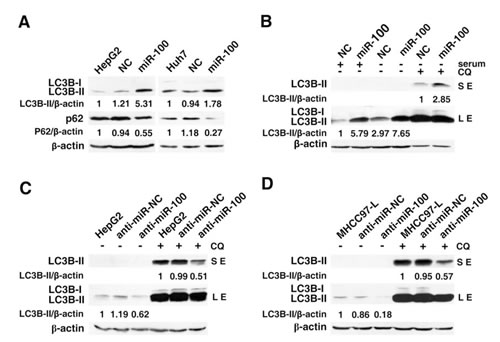 Effect of miR-100 on the levels of LC3B-II and p62 in HCC cells.