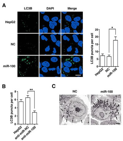 Morphological examination discloses the autophagy-promoting function of miR-100.