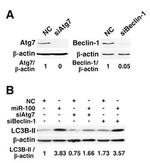 Knockdown of Atg7 but not Beclin-1 attenuates the miR-100-induced autophagy.