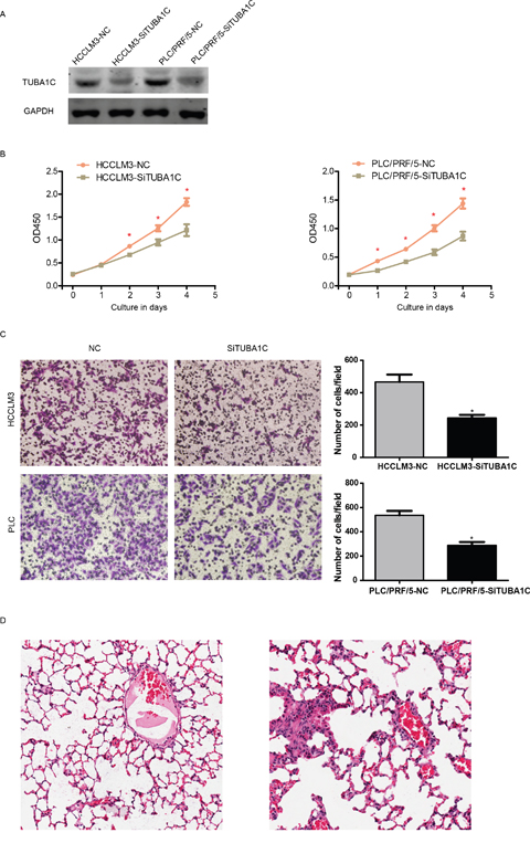 TUBA1C promotes metastasis and proliferation in vitro and in vivo.