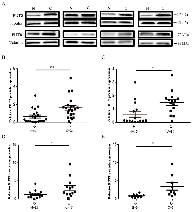 The protein expression levels of FUT2 and FUT8 in lung cancer.