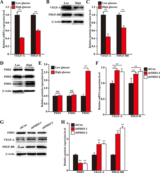 Hyperglycemia suppresses angiogenic factors expression in skeletal muscle cells by inducing PHD3 protein accumulation.
