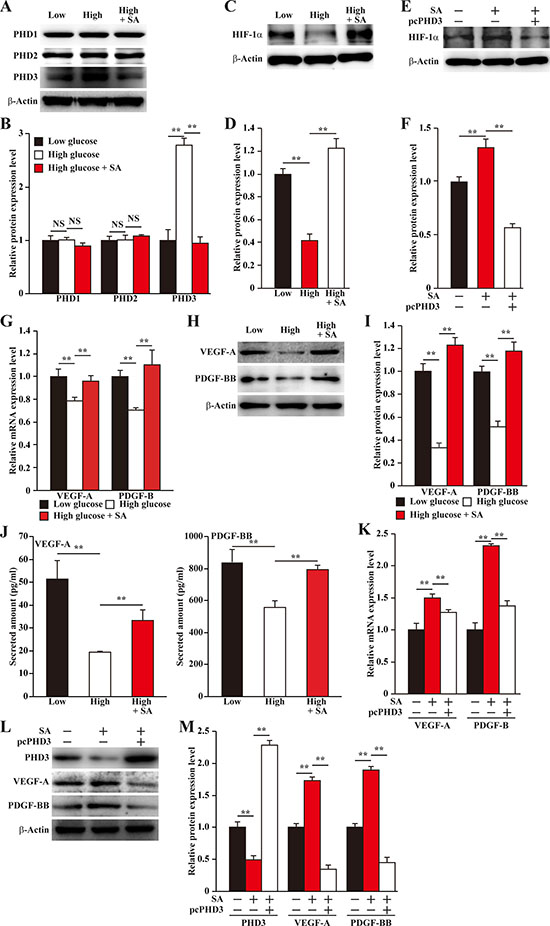 Salidroside restores the expression of skeletal muscle cells angiogenic factors repressed by hyperglycemia.