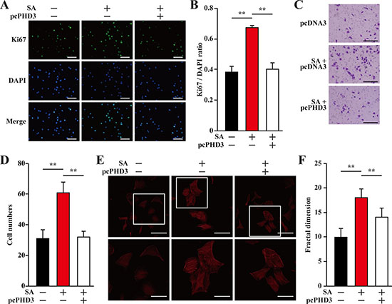 Salidroside enhances endothelial cells proliferation and migration potentials by suppressing hyperglycemia-induced skeletal muscle cells PHD3 accumulation.