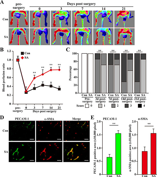 Salidroside promotes blood perfusion recovery by inducing neoangiogenesis in diabetic HLI model mice.
