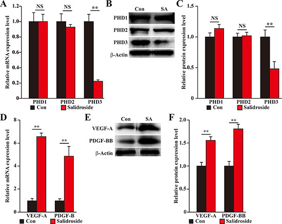 Salidroside promotes blood perfusion recovery by suppressing PHD3 and promoting angiogenic factors expression in the gastrocnemius muscle of diabetic HLI model mice.