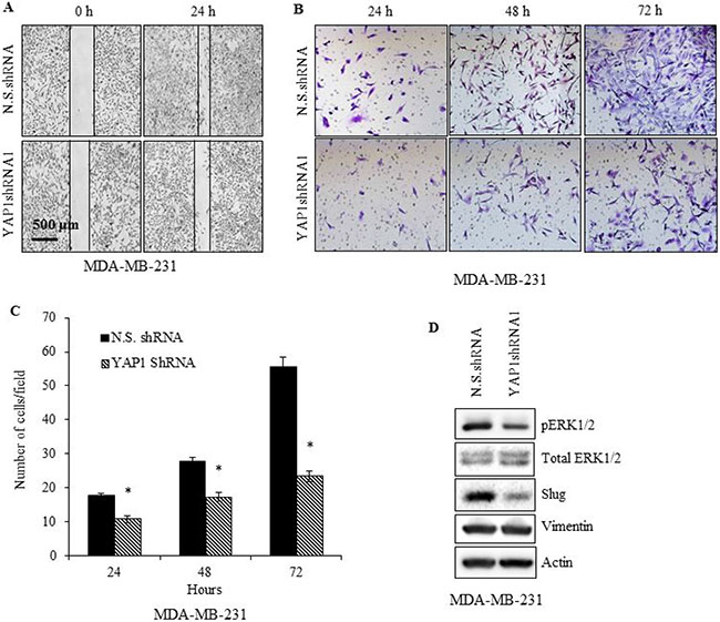 YAP1 silencing impairs MDA-MB-231 cell migration.