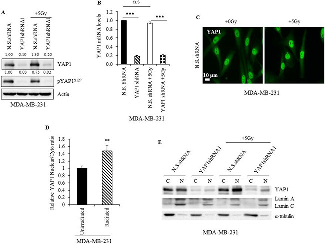 Radiation promotes YAP1 stabilization and nuclear translocation in TNBC cells.