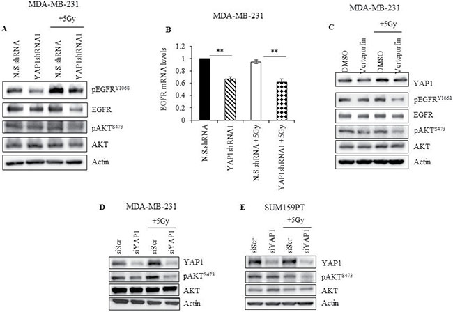 YAP1 activity is required to sustain EGFR and PI3K/AKT signaling during radiation in TNBC cells.