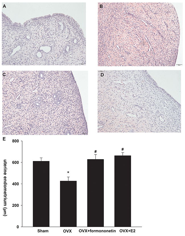 Effect of formononetin on the uterine endometrium of OVX rats.