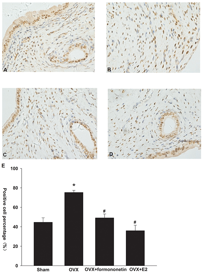 Effect of formononetin on the level of ERa protein in the uterine tissue of OVX rats.