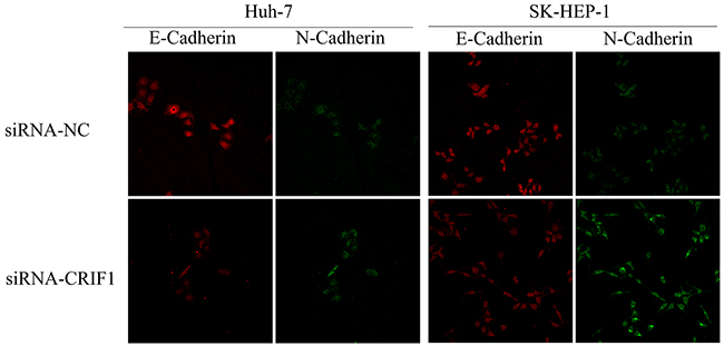 Immunofluorescent double staining of E-Cadherin and N-Cadherin.