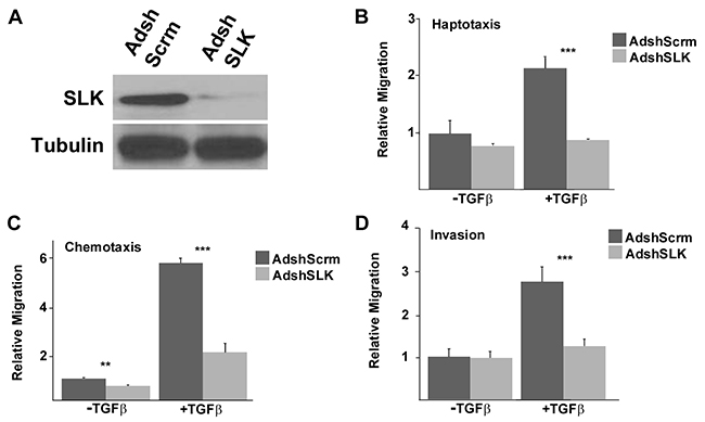 SLK depletion inhibits TGF &#x03B2;-induced motility and invasion.
