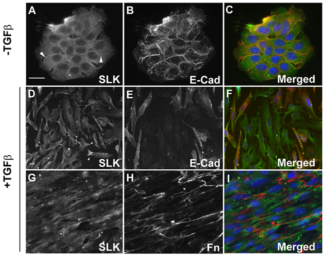 Localization of SLK in murine mammary epithelial cell.