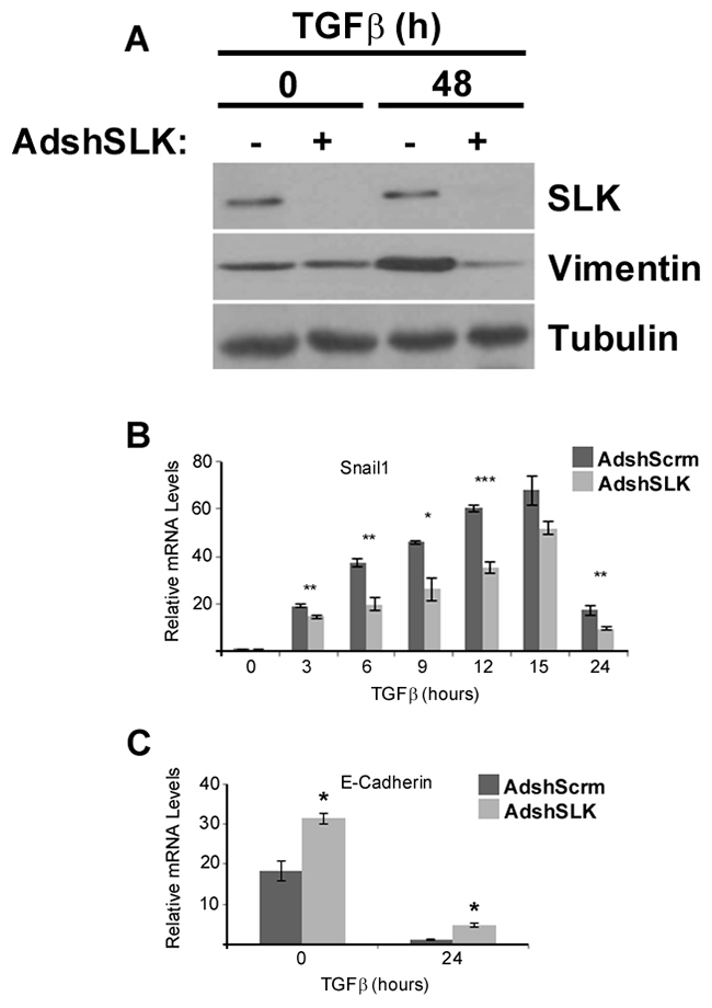 SLK knockdown significantly inhibits Snai1 and vimentin expression following TGF&#x03B2;1 treatment.