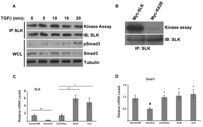 SLK regulates EMT independently of its kinase activity.