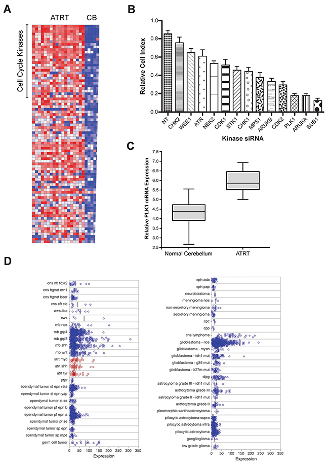 Microarray gene expression analysis and a genome-wide RNAi screens for kinases regulating ATRT cell proliferation: PLK1 identified as a potential target.