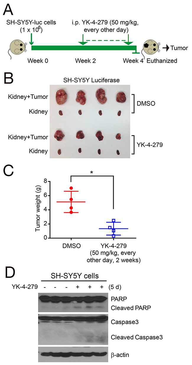 YK-4-279 inhibits tumor growth in orthotopic NB xenograft mouse models.