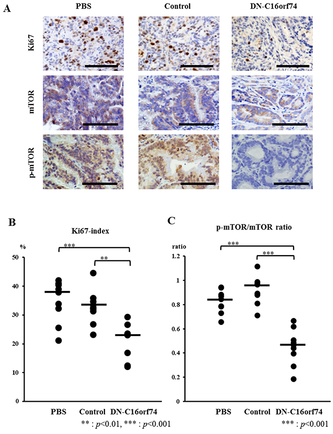 Analysis of cell proliferation (Ki67), mTOR, and p-mTOR in pancreatic tumors from peptide-treated mice.