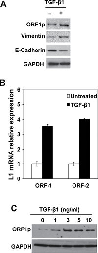 Activation of EMT Programming by TGF-&#x03B2;1 is Associated with LINE-1 Expression in Human Bronchial Epithelial Cells.