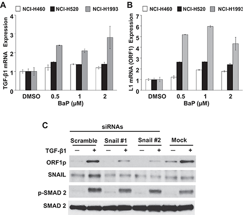 Specificity of TGF-&#x03B2;1/LINE-1 Interactions in Transformed Lung Epithelial Cell Lines.