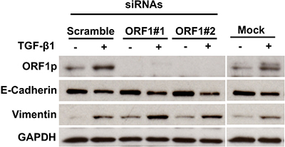 Impact of LINE-1 ORF-1 siRNAs on EMT Programming.