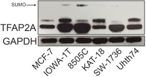 Expression of SUMO-conjugated TFAP2A in ATC Cell Lines.