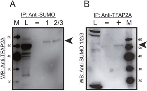 Immunoprecipitation of SUMO Conjugated TFAP2A.