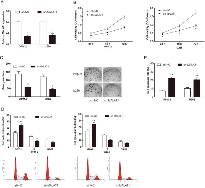 Effects of MALAT1 on MM cells proliferation in vitro.