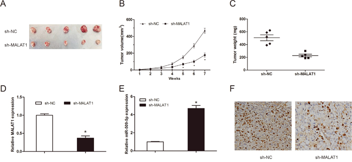 MALAT1 knockdown inhibited tumor growth in vivo.