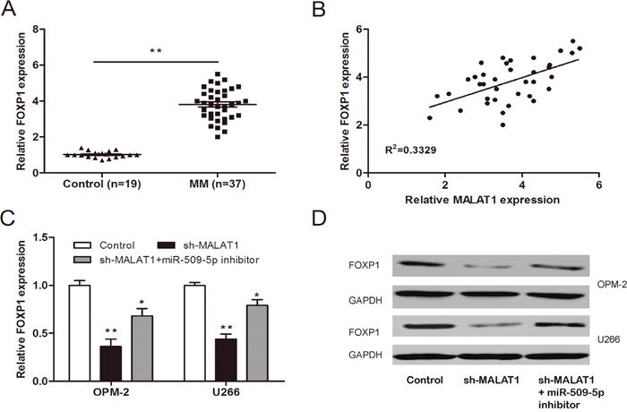 MALAT1 regulated FOXP1 expression via miR-509-5p.