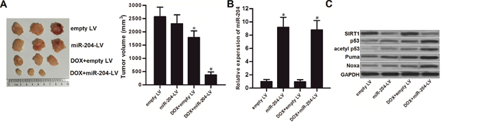 MiR-204 enhances the anti-tumor effect of DOX on LNCaP in vivo.