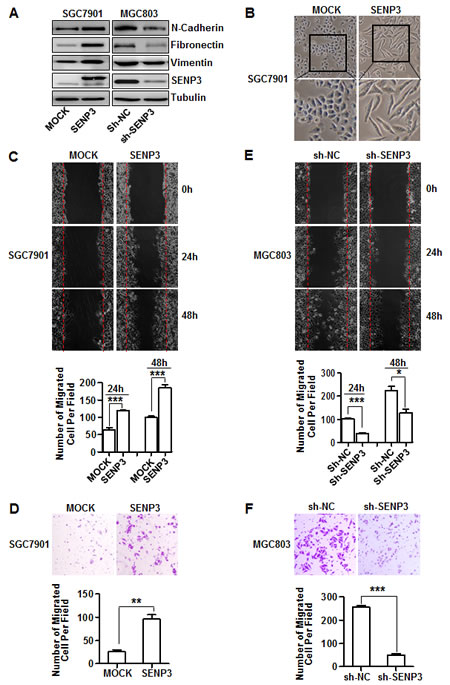 SENP3 induces the EMT in gastric cancer cells.