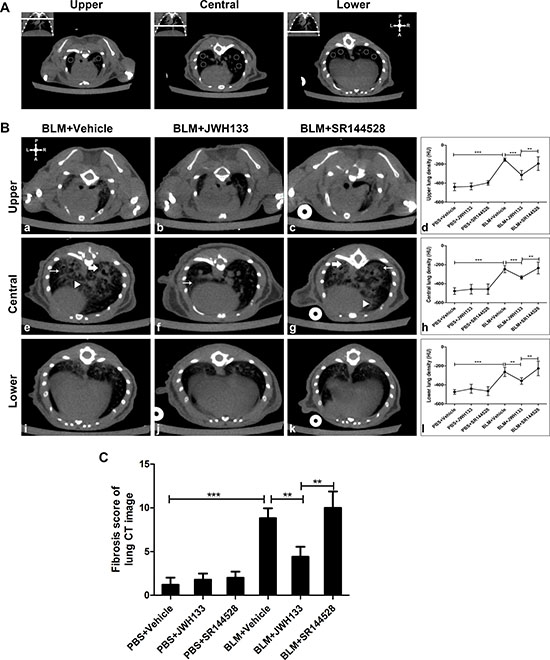 CB2R agonist JWH133 prevents BLM-induced computed tomography images of lung damage and fibrosis in mice.