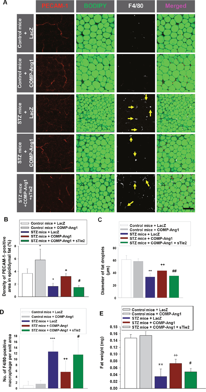 Changes of vascular endothelial cells, fat droplets and macrophage infiltration in adipose tissue.