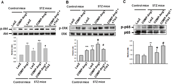 Immunoblotting analyses of phospho-Akt, phosphor-ERK and phospho-p65 from the kidney of STZ-induced mice.