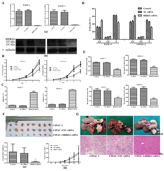 HERG1 siRNA silencing inhibits pancreatic cancer progression in vitro and vivo.