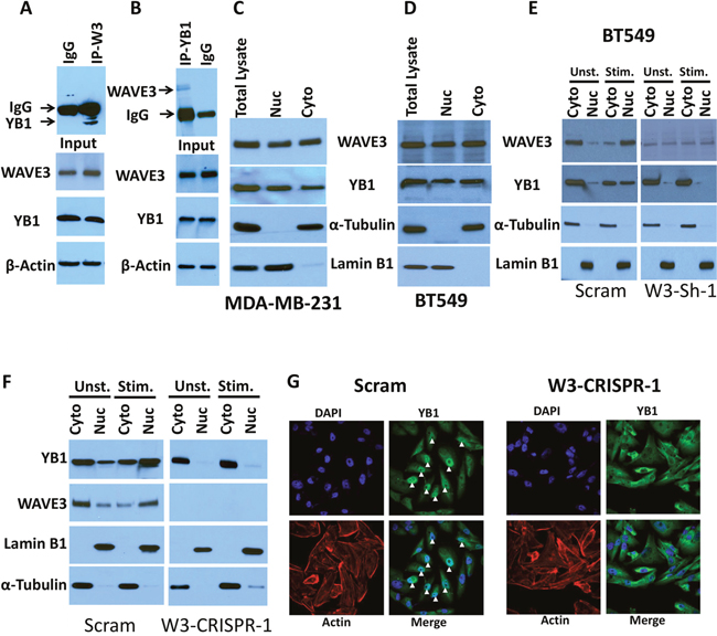 WAVE3 modulates CSC maintenance through its interaction with YB1 protein.