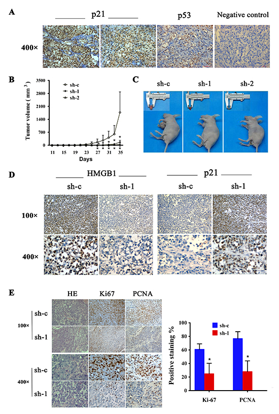 Expression of p21 and p53 in human cutaneous melanoma and effect of HMGB1 inhibition on tumorigenicy of melanoma cell lines.