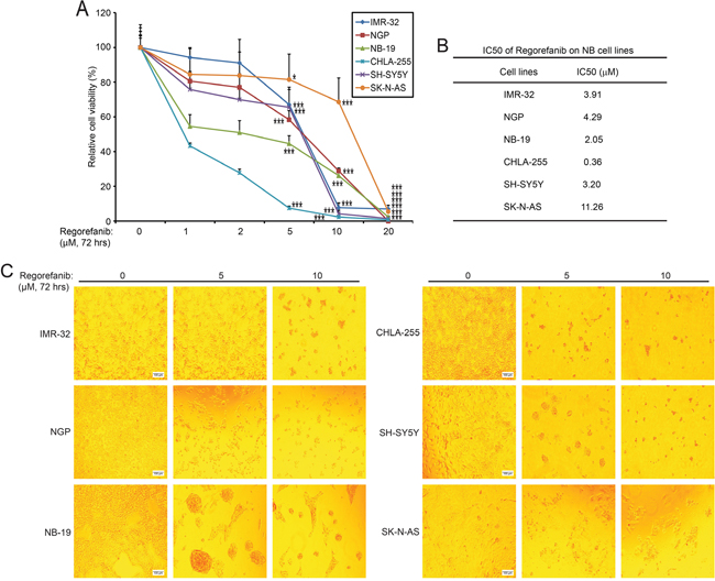 RET inhibitor regorafenib shows cytotoxic effects on NB cell lines.