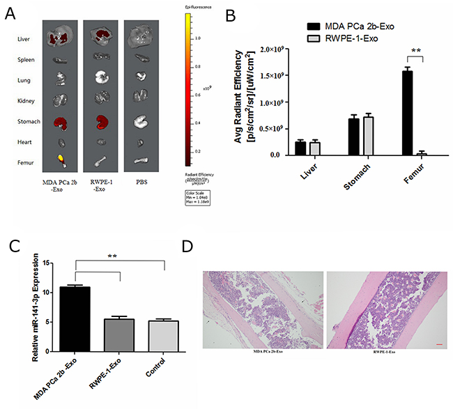 Exosomal miR-141-3p promotes osteoblast activity in vivo.