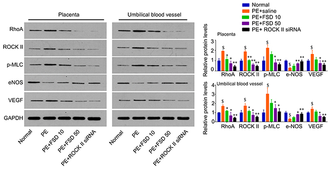 Fasudil regulates the expression of RhoA, ROCK, p-MLC, eNOS and VEGF in placenta and umbilical vessel from PE mice.