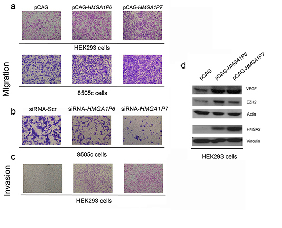 The expression of the HMGA1Ps affects cell migration and invasion.