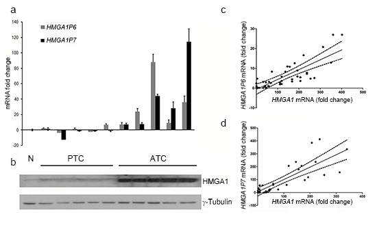 HMGA1 protein expression positively correlates with the expression of the HMGA1Ps in ATC.