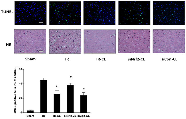 CL alleviates neuronal death at 7 days after MCAO.